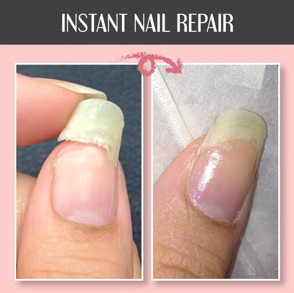 Repairing and Protecting Nail Gel: Strengthens and Regenerates